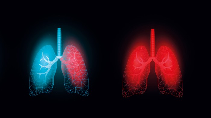 asthma, lungs.jpg